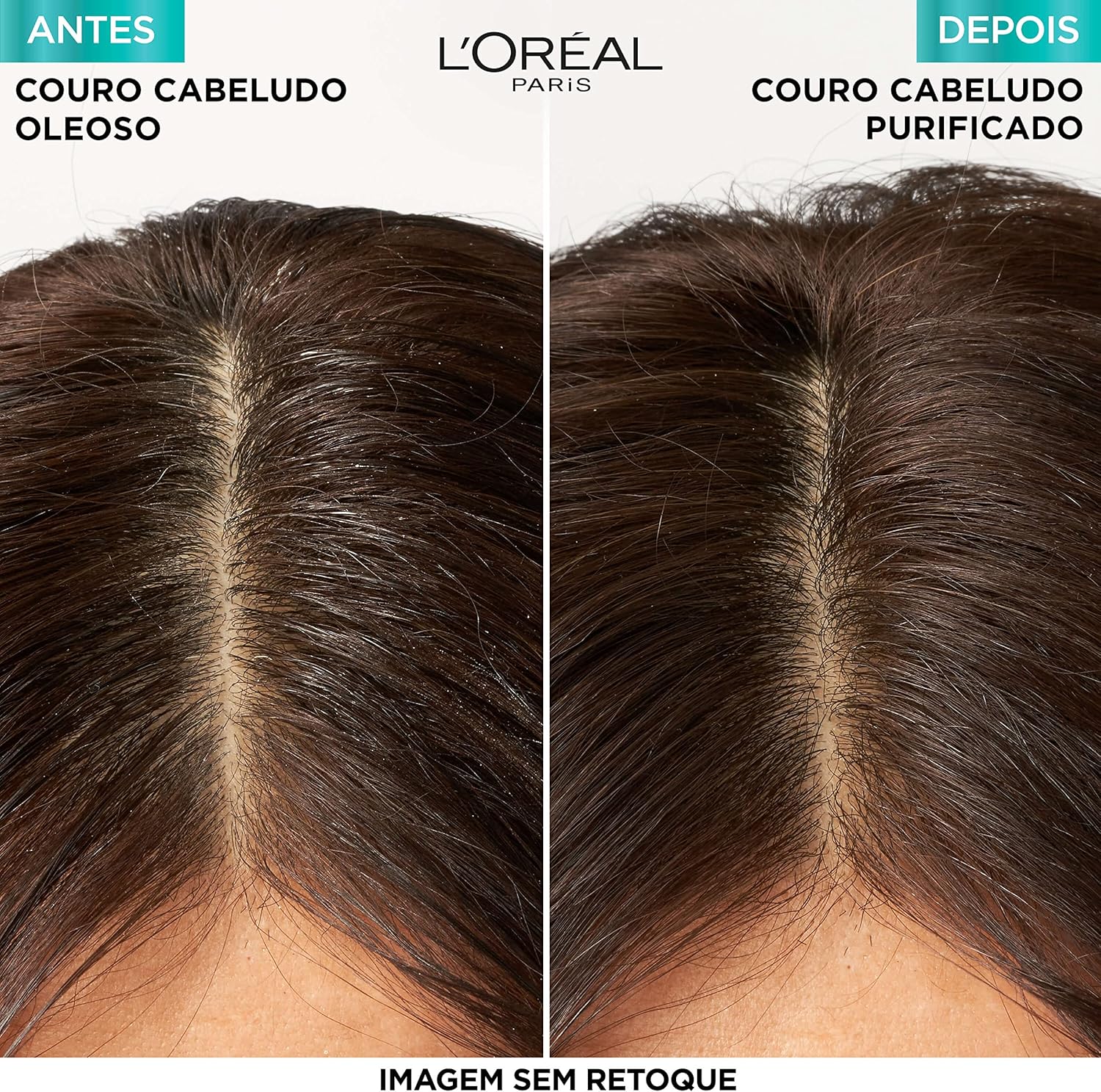 ELSÉVE Shampoo L'Oréal Paris Elseve Pure Hialurônico 400Ml