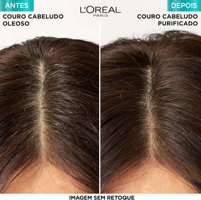 ELSÉVE Shampoo L'Oréal Paris Elseve Pure Hialurônico 400Ml